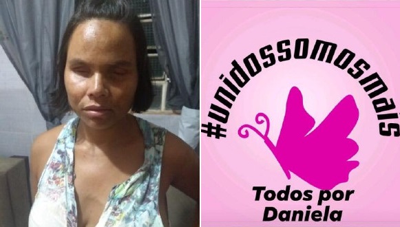 ONG ‘Unidos Somos Mais’ fará evento em prol de Daniela, diagnosticada com câncer