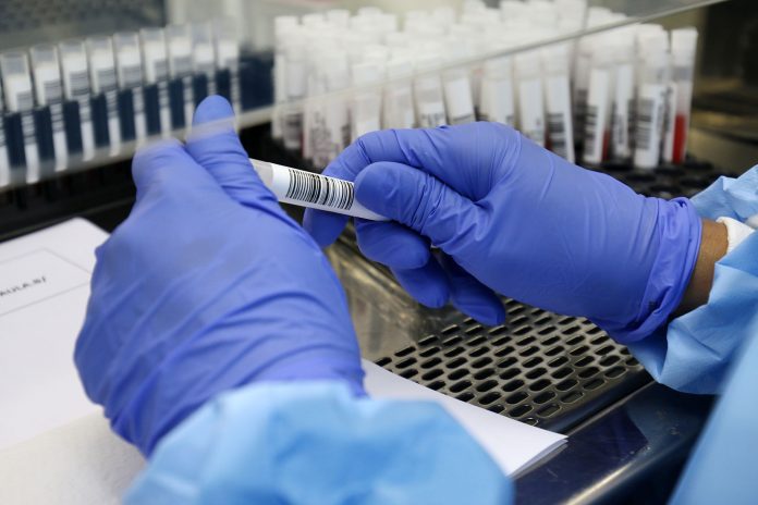 Bahia confirma transmissão comunitária da variante da Covid-19 do Reino Unido