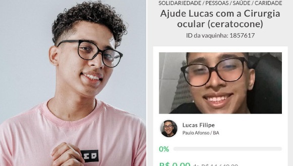 Jovem pauloafonsino com doença rara que compromete a visão faz vaquinha virtual por cirurgia; saiba como colaborar