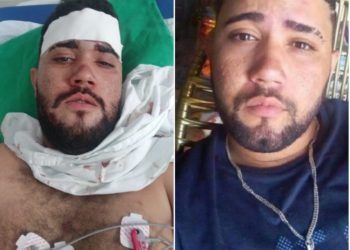 Jovem leva três tiros após assalto com roubo de R$ 4 mil em Paulo Afonso; uma bala está alojada na cabeça