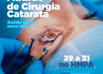 Mutirão de Catarata realiza 850 cirurgias no HMPA de 29 a 31 de outubro