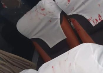 Jogadores ficam feridos após ônibus do Bahia ser atingido por bomba na Arena Fonte Nova