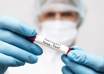 Com mais um caso, Bahia confirma 40 pessoas infectadas com varíola dos macacos