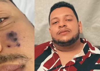 Enteada de cantor de forró que morreu após ser picado por aranha segue internada