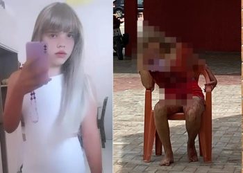 Mulher trans que sofreu 10 facadas em tentativa de homicídio saiu de Paulo Afonso para encontro com namorado em Glória-BA, revela família